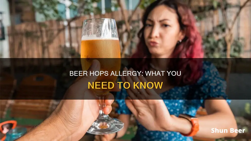 am I allergic to hops in beer