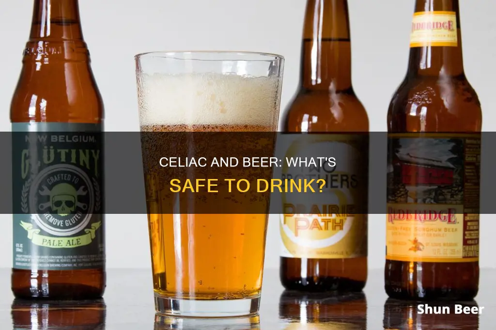 can a celiac drink beer