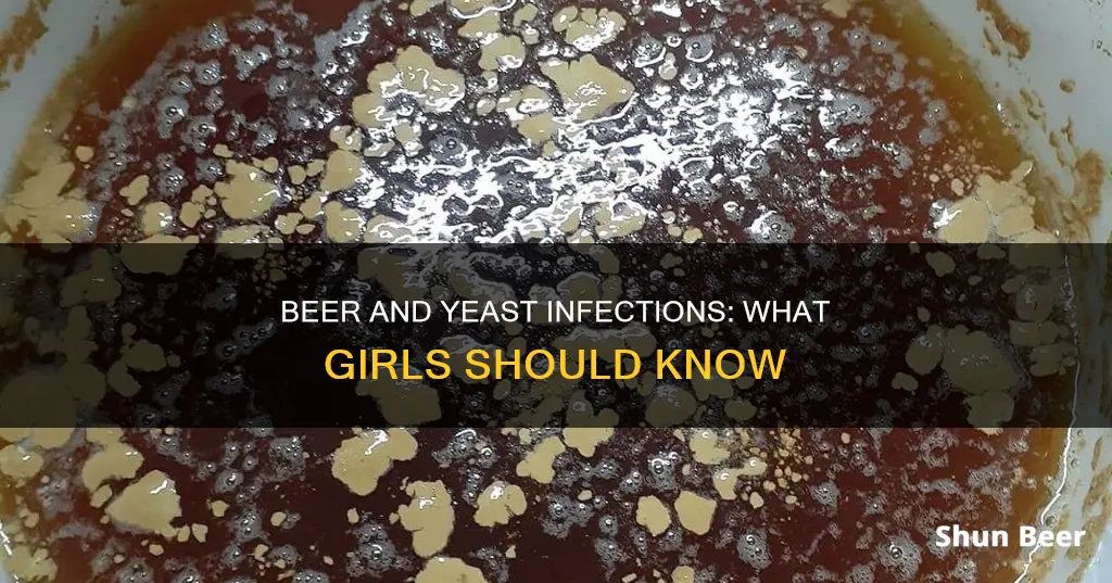 can a girl get a yeast infection from drinking beer