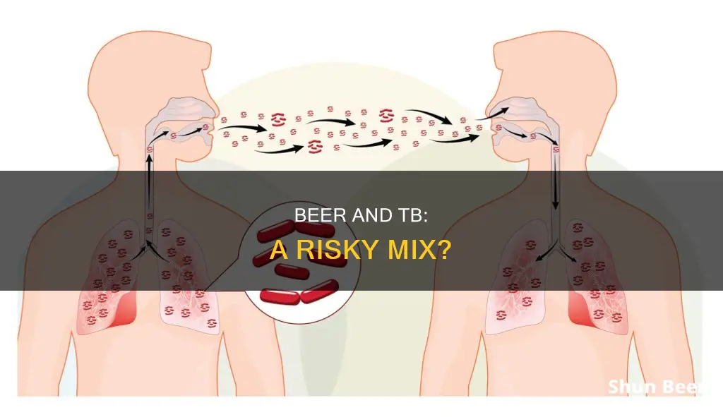 can a tb patient drink beer