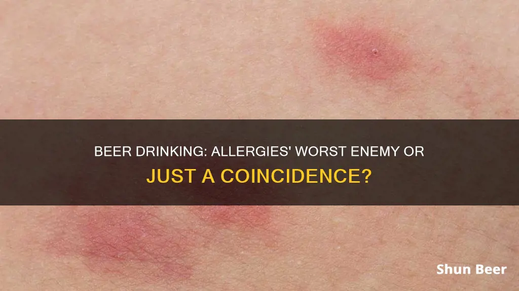 can beer drinking affect your allergies