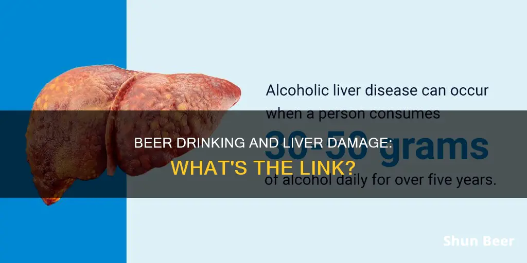 can beer drinking cause liver damage