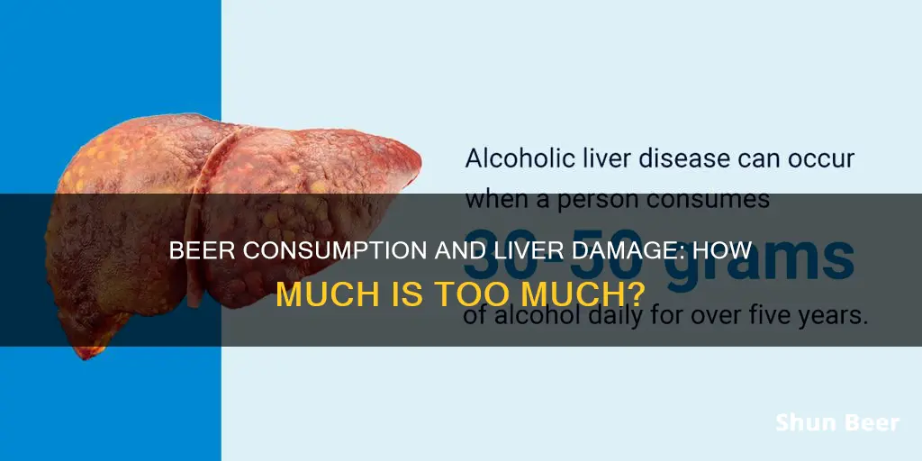 can drinking 3 beers a day cause liver damage