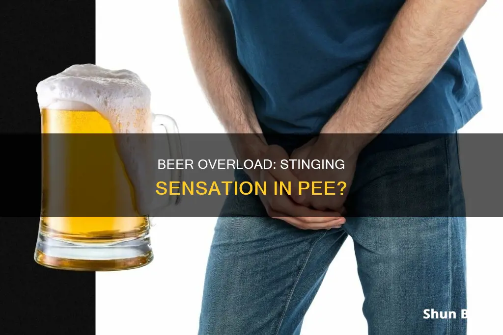 can drinking alit of beer make pee to sting