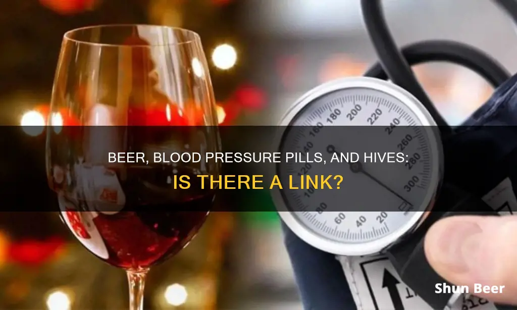 can drinking beer and high blood pressure pills cause hives