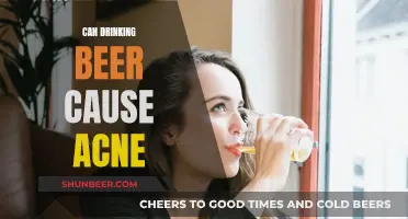 Beer and Acne: Is There a Connection?