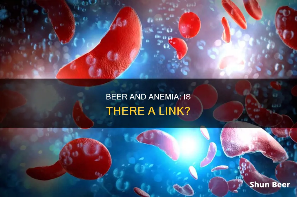 can drinking beer cause anemia