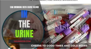 Beer and Blood in Urine: Is There a Link?