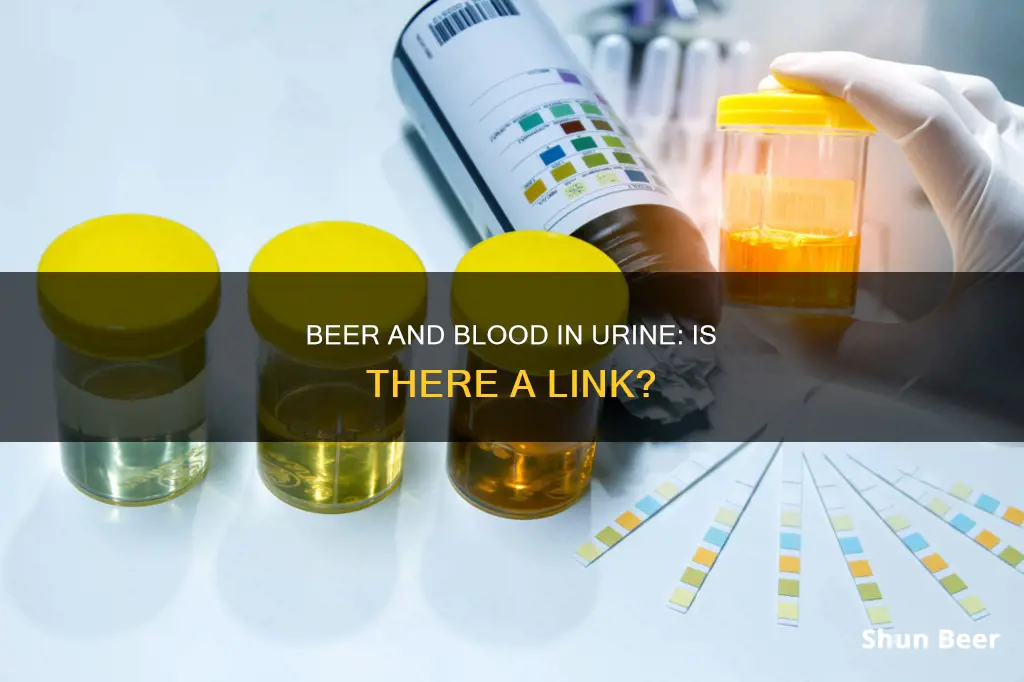 can drinking beer cause blood in the urine