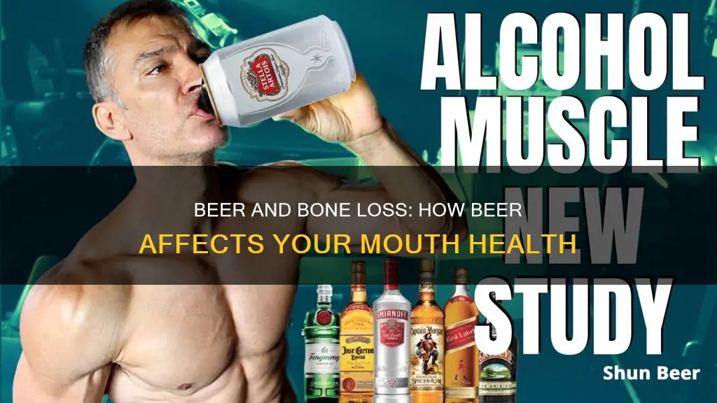 can drinking beer cause bone loss in your mouth