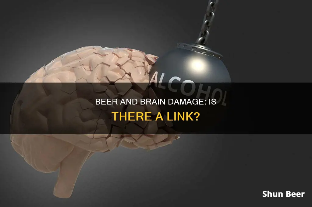 can drinking beer cause brain damage