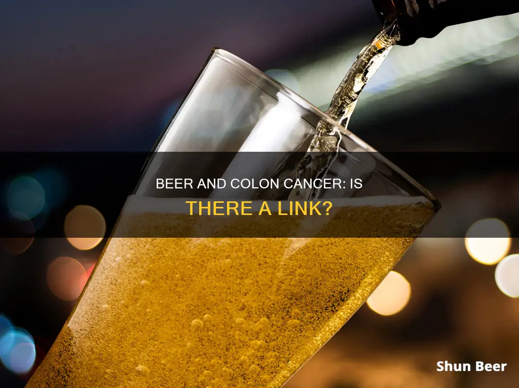 can drinking beer cause colon cancer