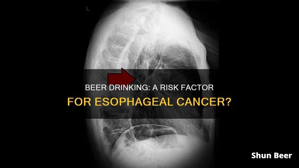 can drinking beer cause esophageal cancer