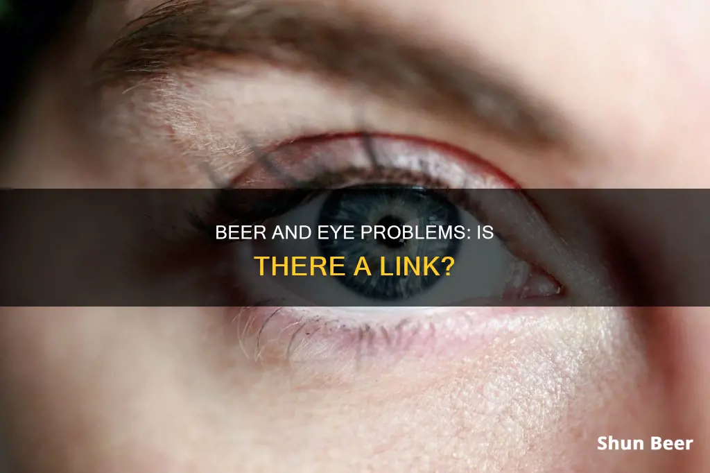 can drinking beer cause eye problems