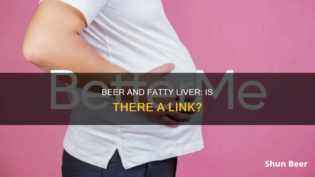 can drinking beer cause fatty liver