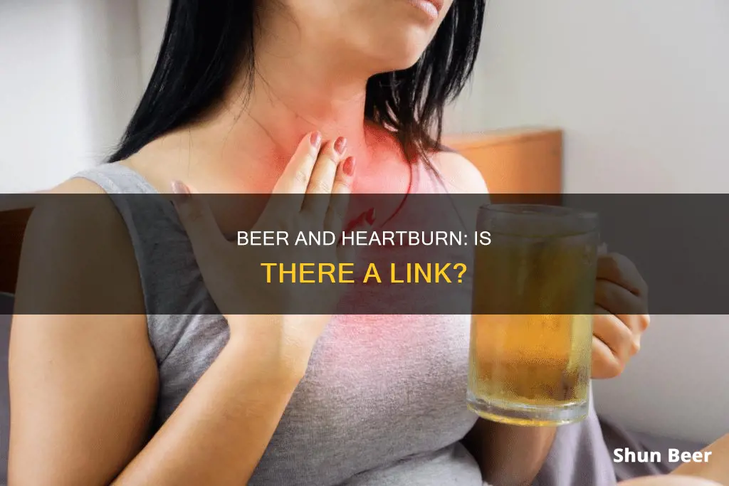 can drinking beer cause heartburn