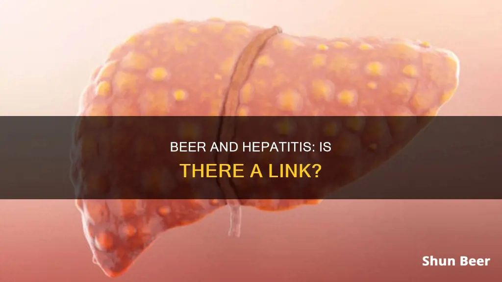 can drinking beer cause hepatitis