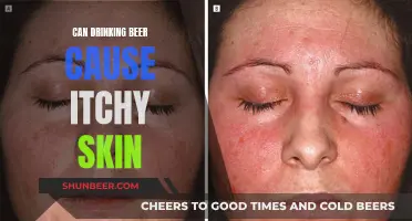 Beer and Itchy Skin: Is There a Connection?