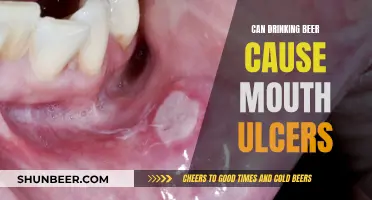 Beer and Mouth Ulcers: Is There a Connection?