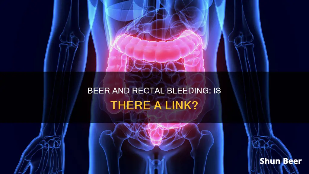 can drinking beer cause rectal bleeding