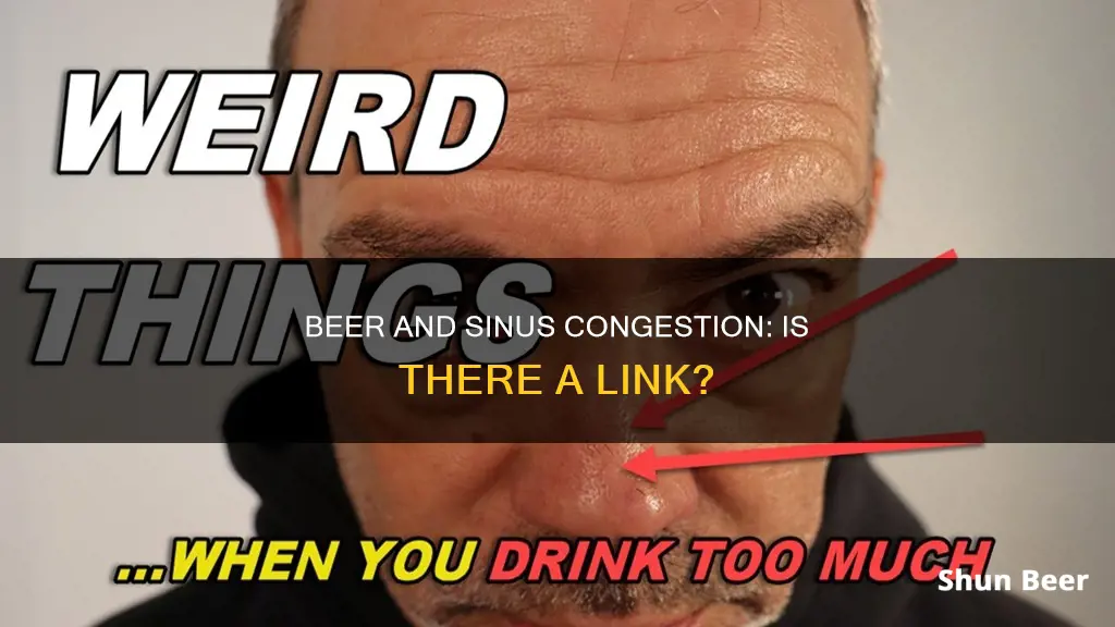 can drinking beer cause sinus congestion