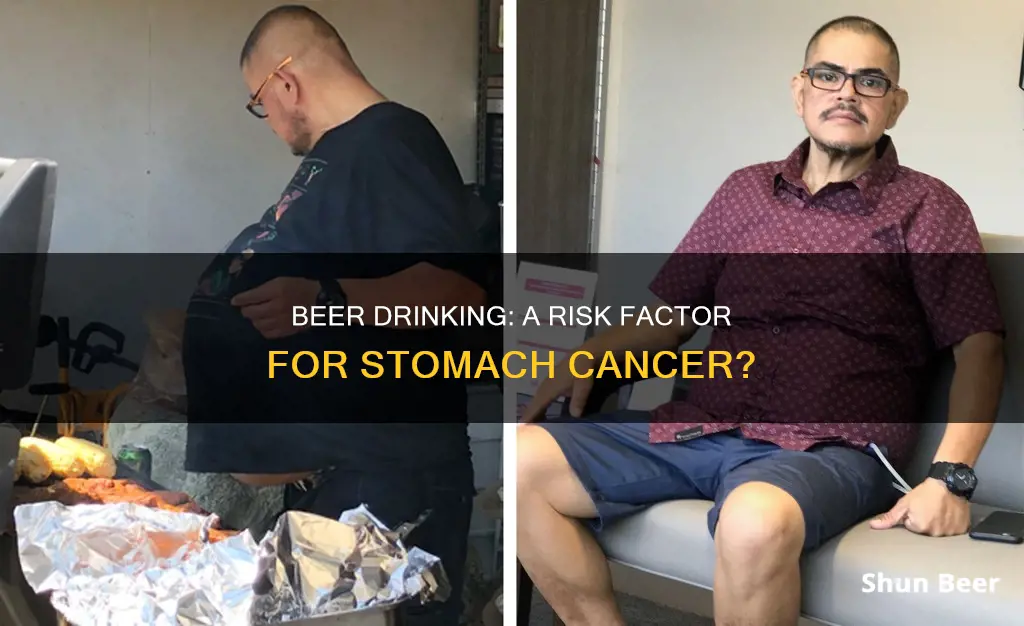 can drinking beer cause stomach cancer