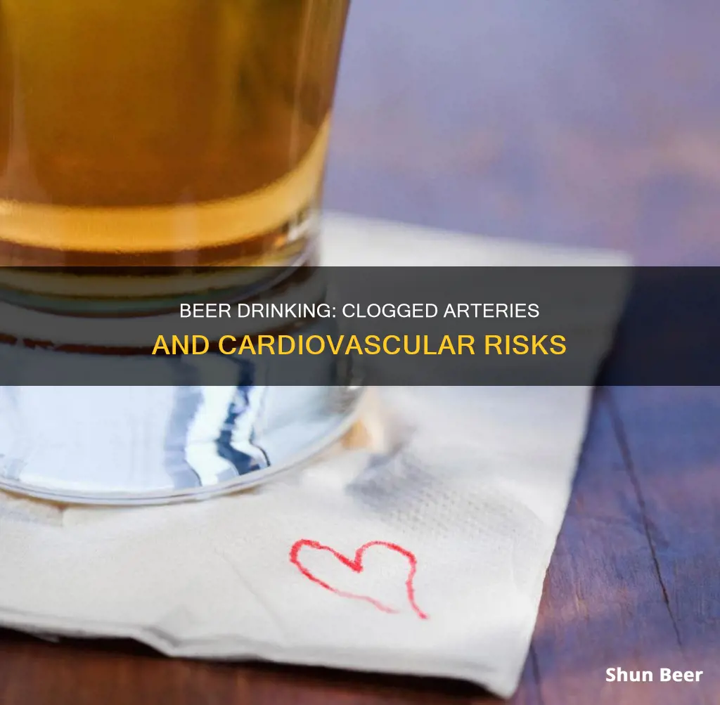 can drinking beer clog your arteries