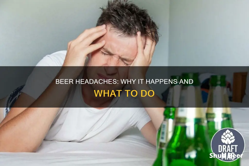 can drinking beer give you a headache