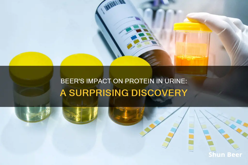 can drinking beer help eliminate protein in urine