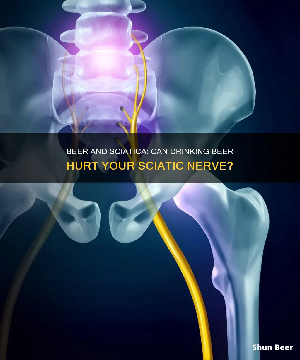 can drinking beer hurt your sciatic nerve