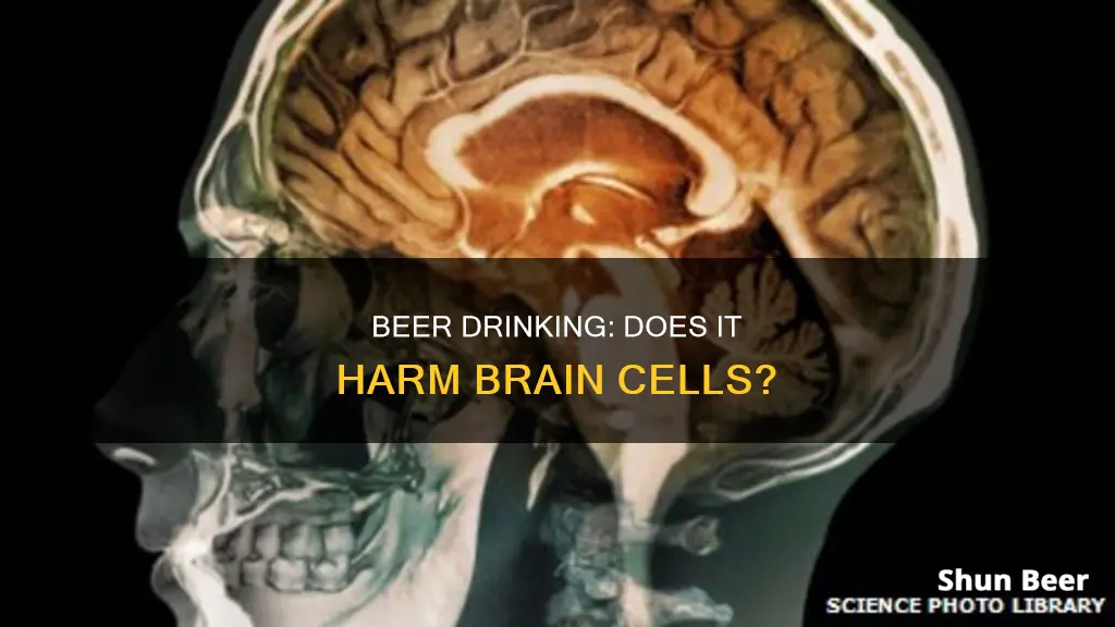 can drinking beer kill brain cells