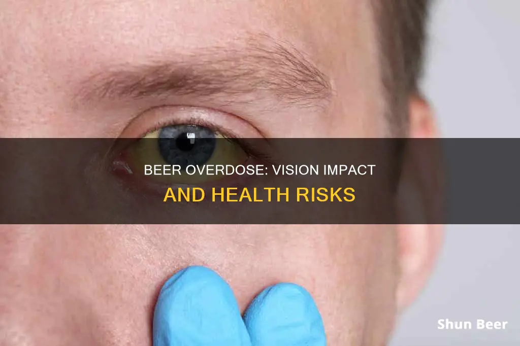 can drinking too much beer affect your eyesight