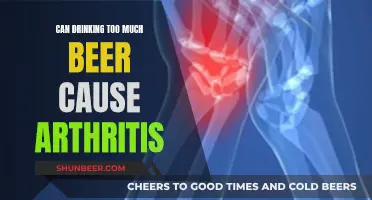 Beer and Arthritis: Is There a Link?