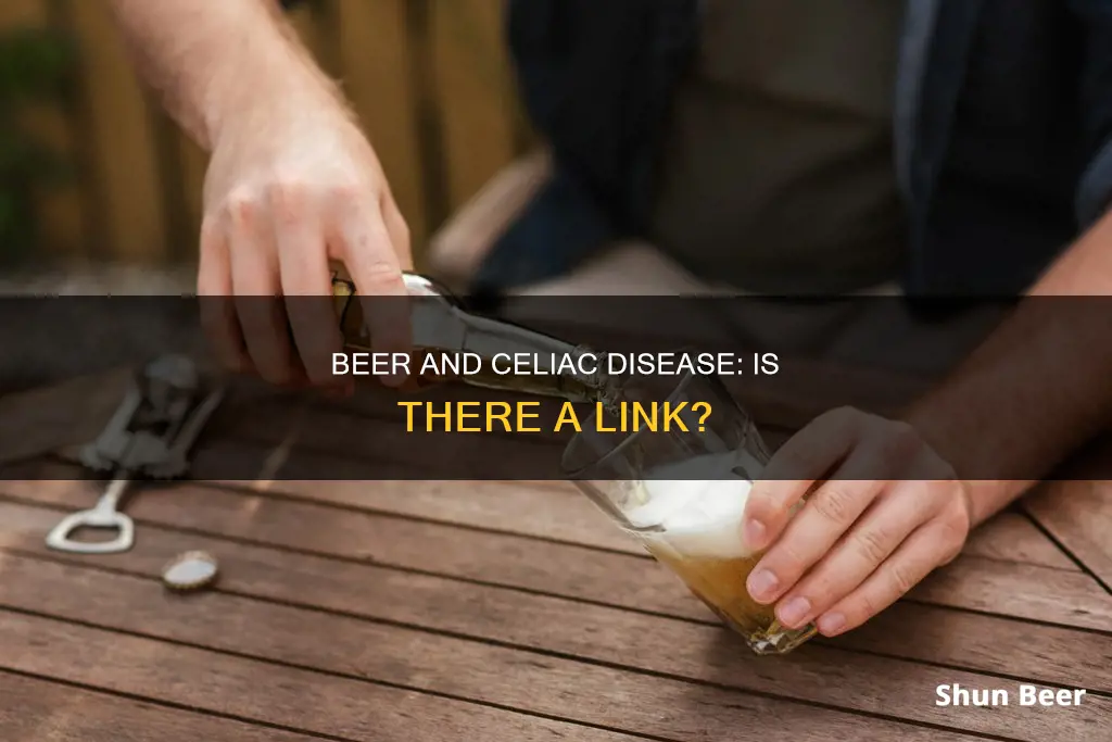 can drinking too much beer cause celiac disease