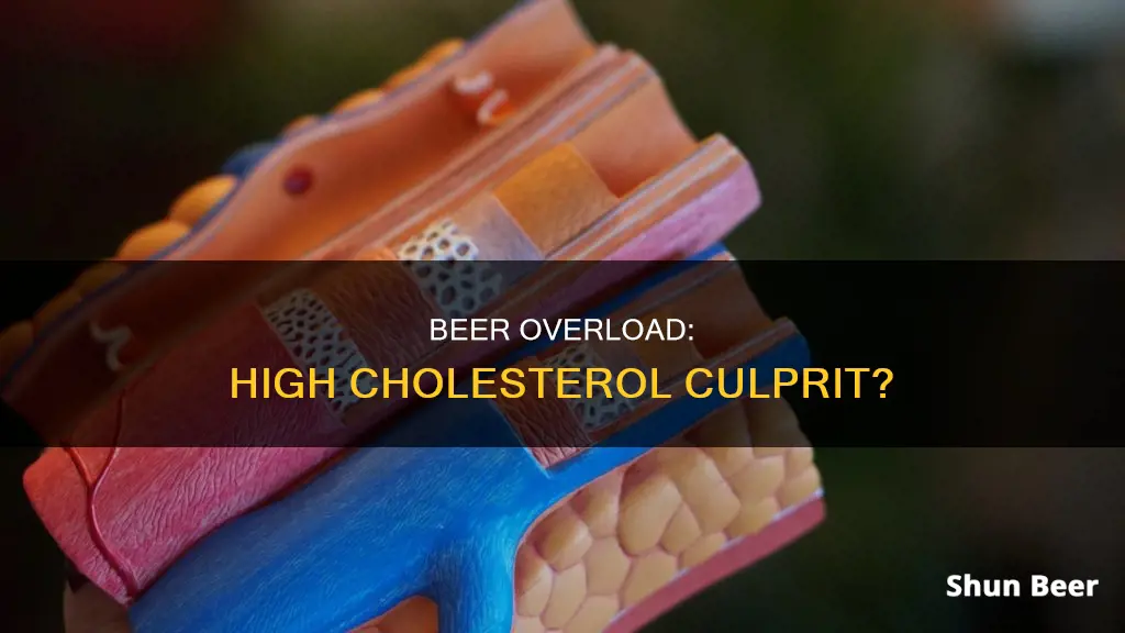 can drinking too much beer cause high cholesterol