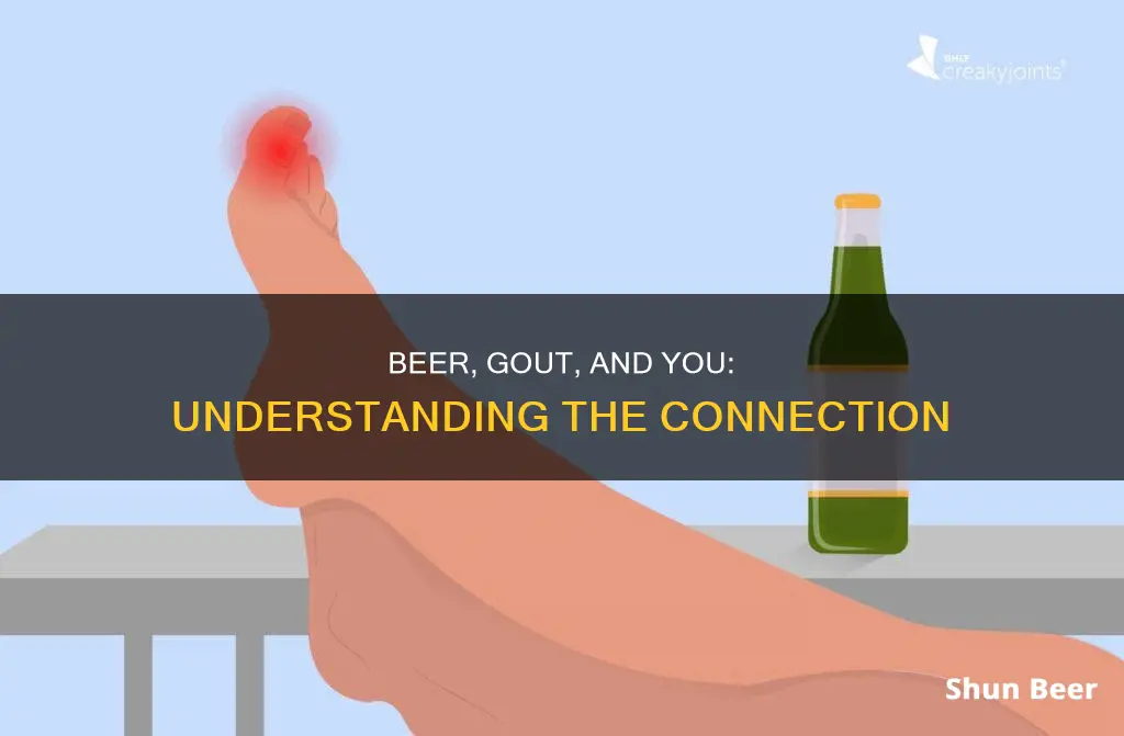 can excessive beer drinking cause gout