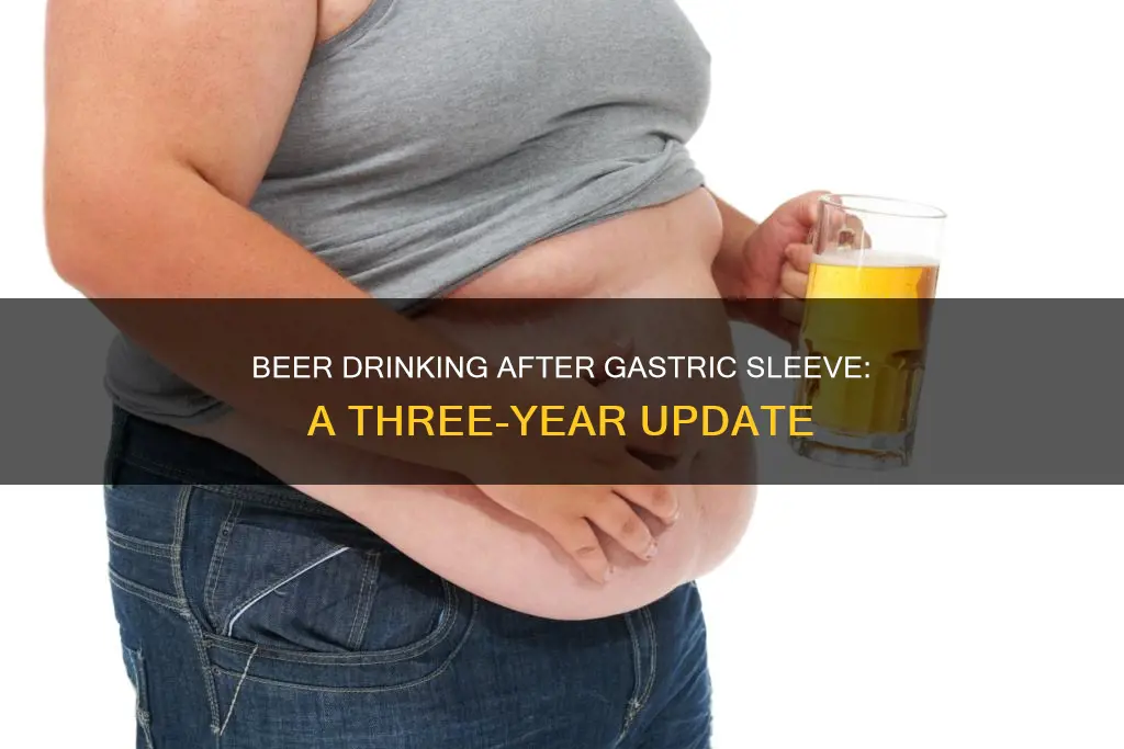 can I drink beer 3 years after gastric sleeve