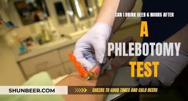 Beer and Blood Tests: Safe Drinking Hours After Phlebotomy