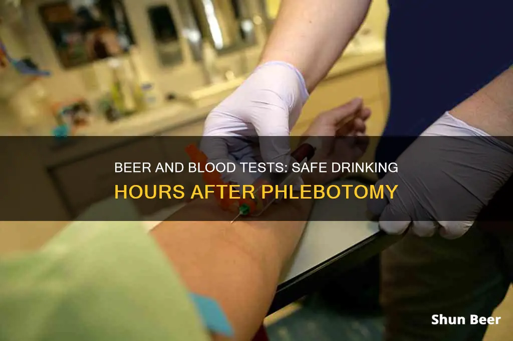 can I drink beer 6 hours after a phlebotomy test