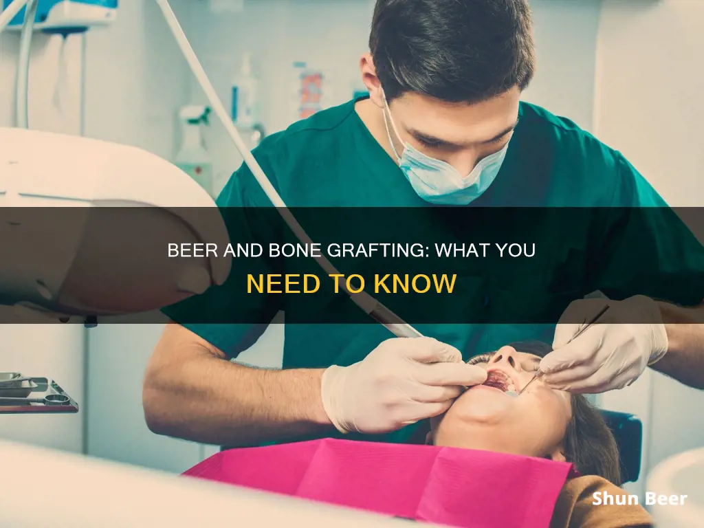 can I drink beer after a dental bone grafy