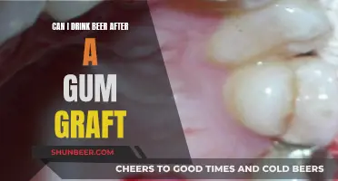 Beer and Gum Grafts: What You Need to Know