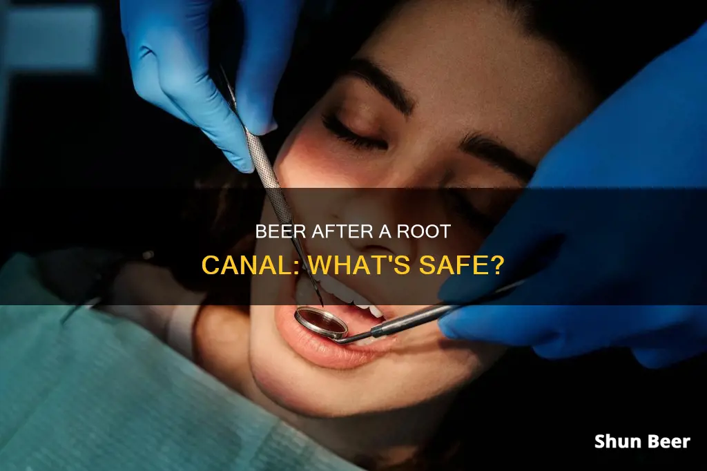 can I drink beer after a root canal