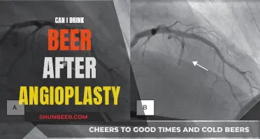 Beer and Angioplasty: What You Need to Know