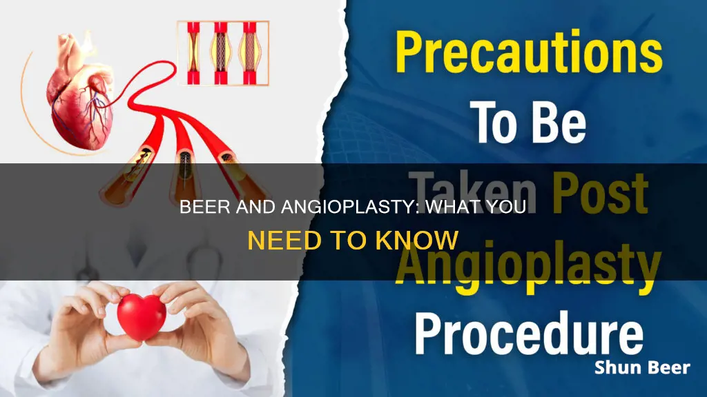 can I drink beer after angioplasty