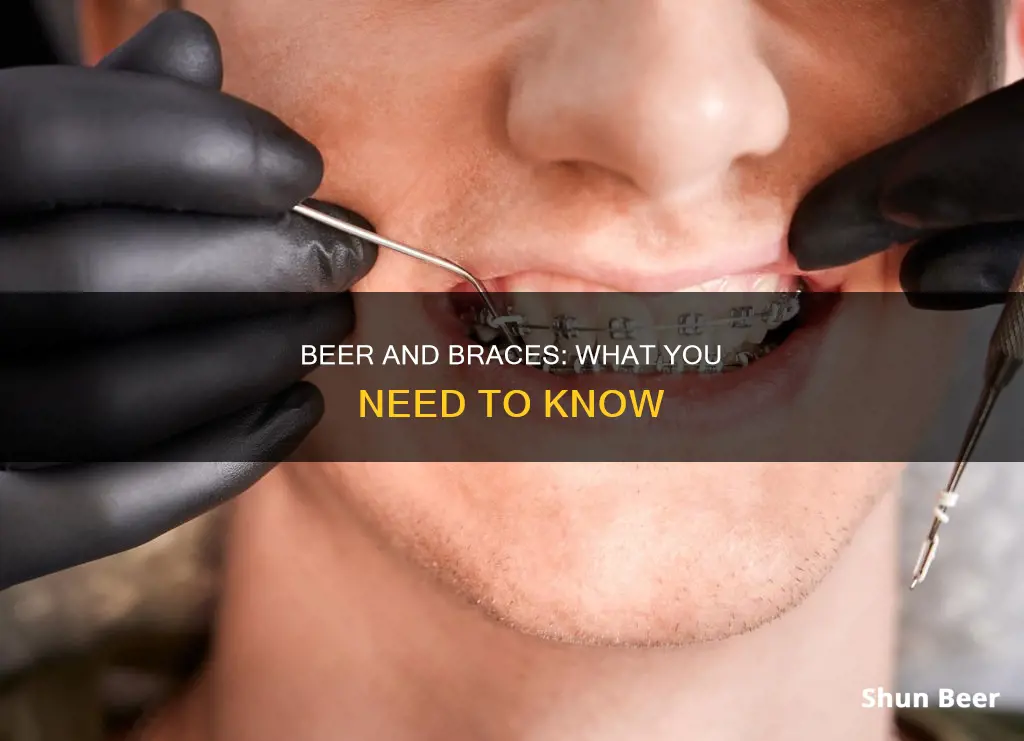 can I drink beer after braces