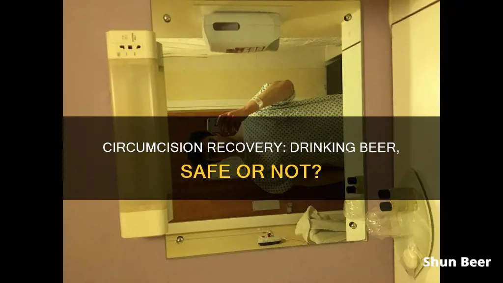 can I drink beer after circumcision