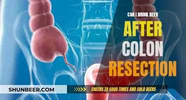 Beer Consumption Post-Colon Resection: What You Need to Know