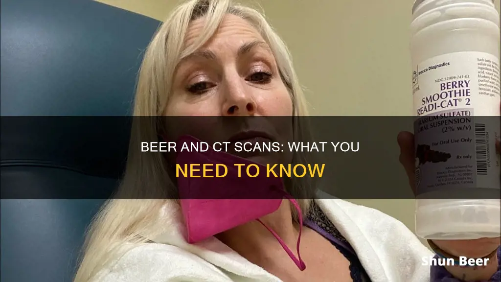 can I drink beer after ct scan with contrast