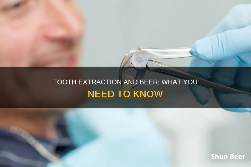 can I drink beer after getting a tooth pulled