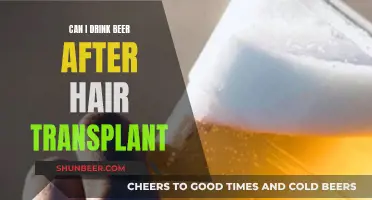 Beer After Hair Transplant: What You Need to Know